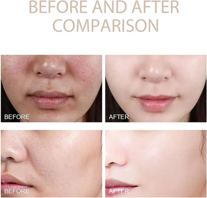 PHANSTA™ Purifying Peeling Gel (BUY 1 GET 1 FREE)